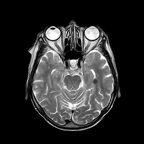 A written request <b>for </b>the study from the referring physician must also be in the medical record and made available upon request when performed in freestanding and independent diagnostic testing facilities. . Rvu for brain mri